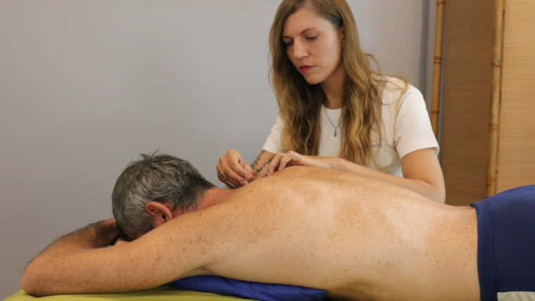 Acupuncture